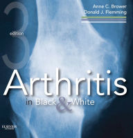 Arthritis in Black and White