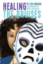 Healing the Bruises