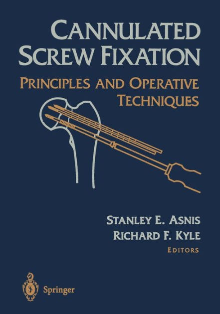 Barnes　Edition　Fixation:　9781461275039　Paperback　Principles　and　by　Asnis　Operative　E.　Techniques　Stanley　Screw　Cannulated　Noble®