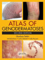 Atlas of Genodermatoses / Edition 2