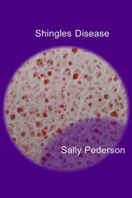 Shingles Disease