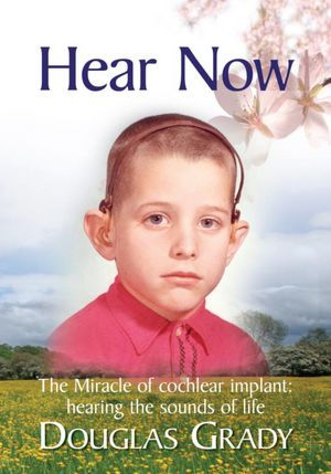 Hear Now: The Miracle of cochlear implant: hearing the sounds of life