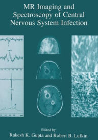 Title: MR Imaging and Spectroscopy of Central Nervous System Infection / Edition 1, Author: Rakesh K. Gupta
