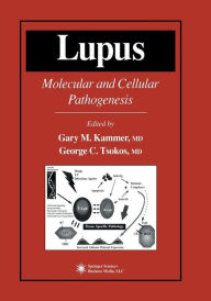 Title: Lupus: Molecular and Cellular Pathogenesis, Author: Gary M. Kammer