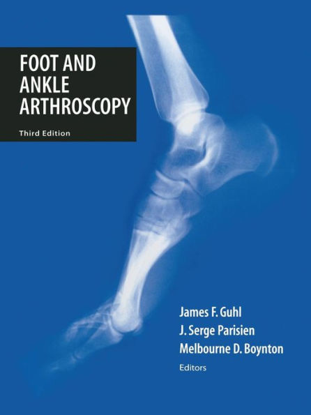 Foot and Ankle Arthroscopy / Edition 3