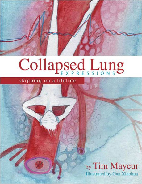 Collapsed Lung Expressions: Skipping on a Lifeline