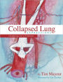 Collapsed Lung Expressions: Skipping on a Lifeline