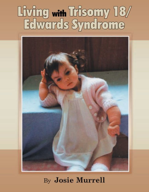 Living With Trisomy 18 / Edwards Syndrome By Josie Murrell | EBook ...