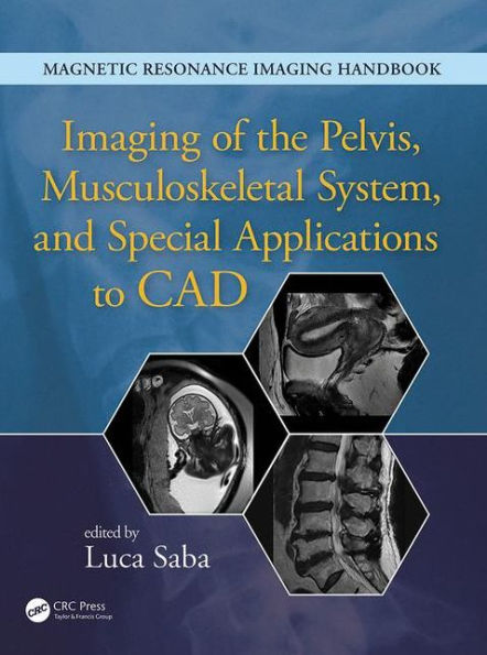 Imaging of the Pelvis, Musculoskeletal System, and Special Applications to CAD / Edition 1