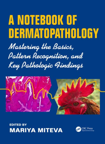 A Notebook of Dermatopathology: Mastering the Basics, Pattern Recognition, and Key Pathologic Findings / Edition 1