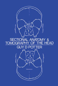 Title: Sectional Anatomy and Tomography of the Head, Author: Guy D. Potter