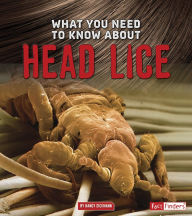 Title: What You Need to Know about Head Lice, Author: Nancy Dickmann