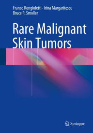 Title: Rare Malignant Skin Tumors, Author: Franco Rongioletti