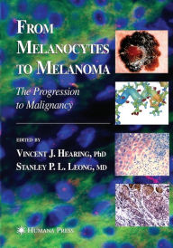 Title: From Melanocytes to Melanoma: The Progression to Malignancy, Author: Vincent J. Hearing