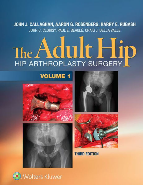 The Adult Hip: Hip Arthroplasty Surgery