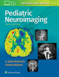 Title: Pediatric Neuroimaging / Edition 6, Author: A. James Barkovich MD