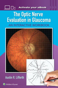 Title: The Optic Nerve Evaluation in Glaucoma: An Interactive Workbook, Author: Austin Lifferth