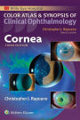 Cornea