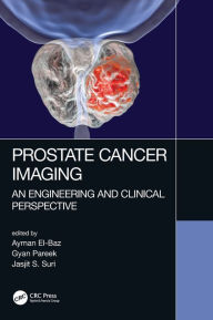 Title: Prostate Cancer Imaging: An Engineering and Clinical Perspective / Edition 1, Author: Ayman El-Baz