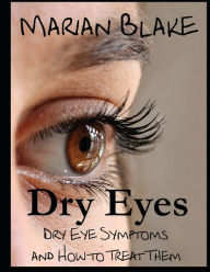 Title: Dry Eyes (Large Print): Dry Eye Symptoms and how to treat them, Author: Marian Blake