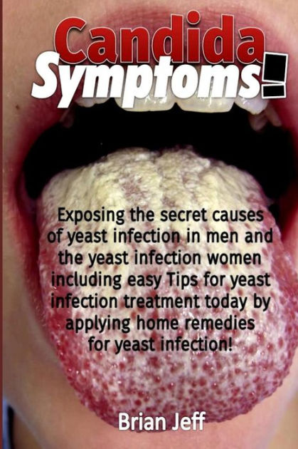 Candida Symptoms Exposing The Secret Causes Of Yeast Infection In Men