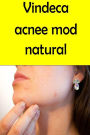 Cure Your Acne naturally (Romanian)