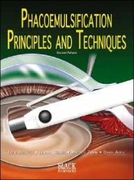 Phacoemulsification: Principles and Techniques / Edition 2