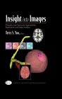 Insight into Images: Principles and Practice for Segmentation, Registration, and Image Analysis / Edition 1