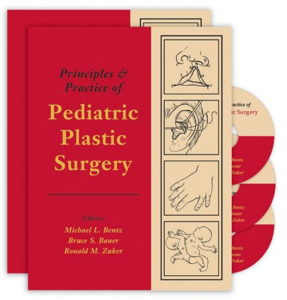 Principles and Practice of Pediatric Plastic Surgery