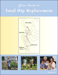 Your Guide to Total Hip Replacement