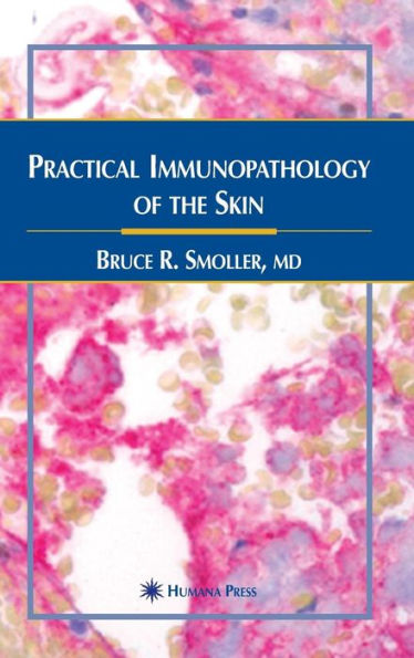 Practical Immunopathology of the Skin / Edition 1