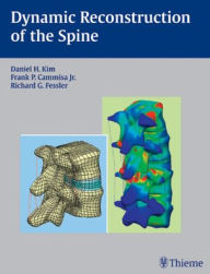 Dynamic Reconstruction of the Spine / Edition 1