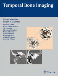 Title: Temporal Bone Imaging, Author: Ellen G. Hoeffner