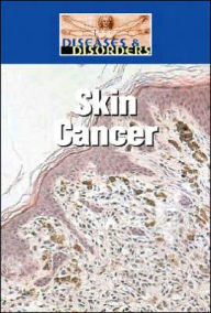 Title: Skin Cancer, Author: Bonnie Juettner
