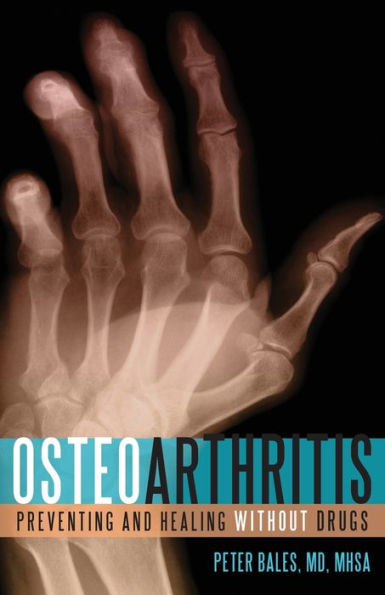 Osteoarthritis: Preventing and Healing Without Drugs