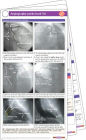 Angiography Pocketcard Set / Edition 1