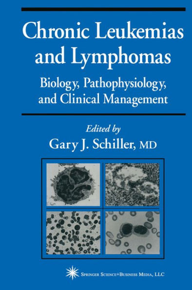 Chronic Leukemias and Lymphomas: Biology, Pathophysiology, and Clinical Management