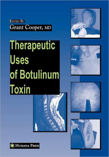 Therapeutic Uses Of Botulinum Toxin By Grant Cooper, Paperback | Barnes ...