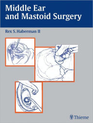 Title: Middle Ear and Mastoid Surgery, Author: Rex S. Haberman