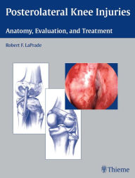 Posterolateral Knee Injuries: Anatomy, Evaluation, and Treatment