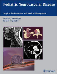 Title: Pediatric Neurovascular Disease: Surgical, Endovascular, and Medical Management, Author: Michael J. Alexander