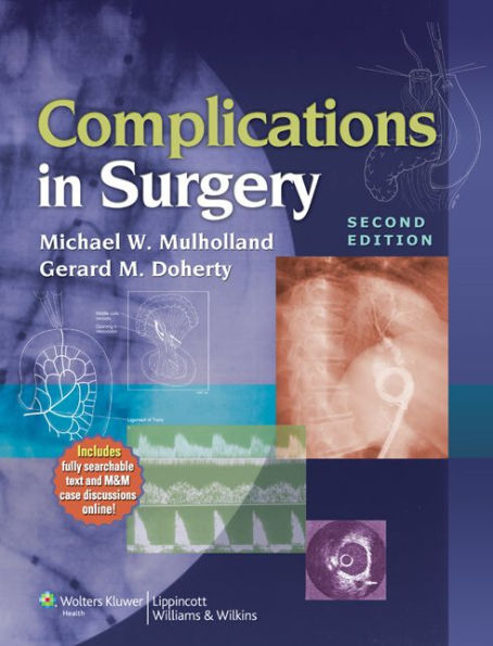 Complications in Surgery / Edition 2