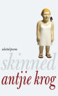 Skinned: Selected Poems