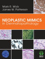 Neoplastic Mimics in Dermatopathology