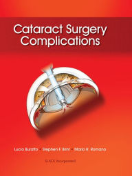 Title: Cataract Surgery Complications, Author: Lucio Buratto