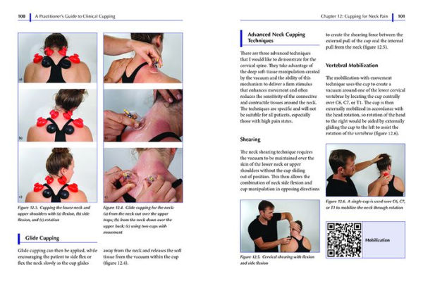 A Practitioner's Guide to Clinical Cupping: Effective Techniques for Pain Management and Injury