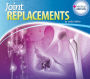 Joint Replacements eBook