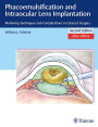 Phacoemulsification and Intraocular Lens Implantation: Mastering Techniques and Complications in Cataract Surgery