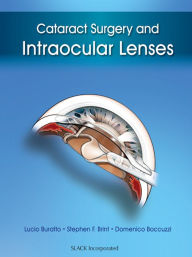 Title: Cataract Surgery and Intraocular Lenses, Author: Lucio Buratto