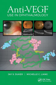 Title: Anti-VEGF Use in Ophthalmology / Edition 1, Author: Jay Duker